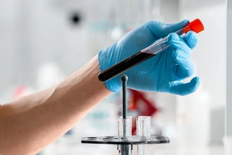Mão enluvada de azul segurando um tubo de ensaio com sangue, colocando-o em um suporte de laboratório